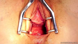 Teen Stuffs  And Fist In Her Pussy