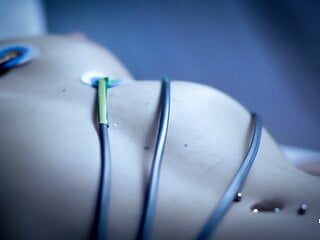 Improvised Topless Ekg