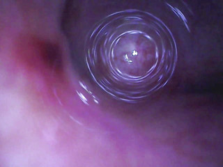 Fiberscope In Urethral Test Tube